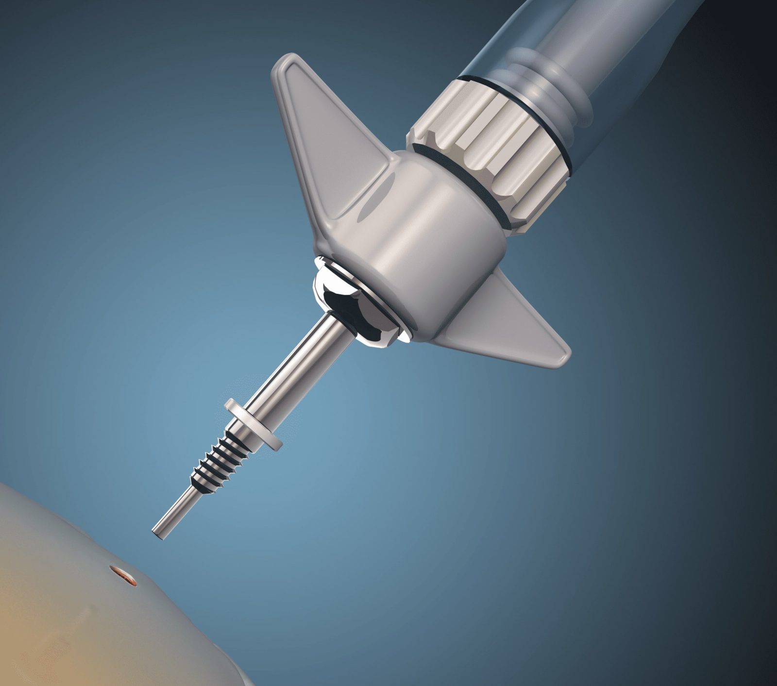 How Medical Illustrations & Animations Maximize Understanding in Instructions for Use and Surgical Training Manuals