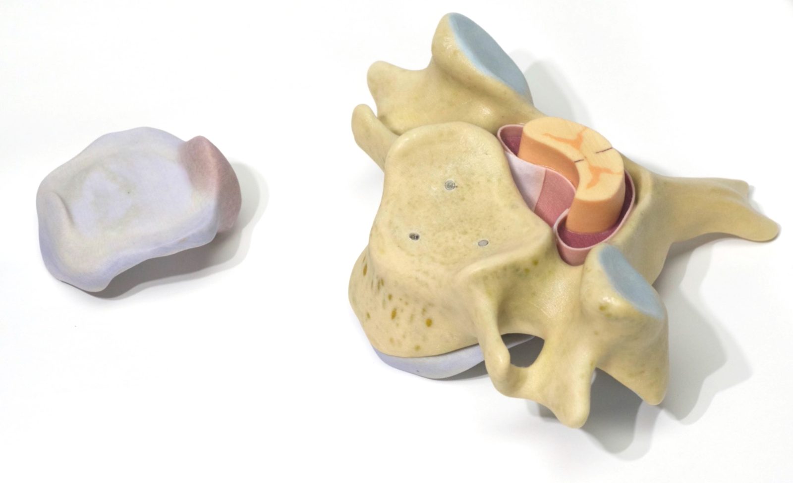 Medical legal 3D model of cervical disc