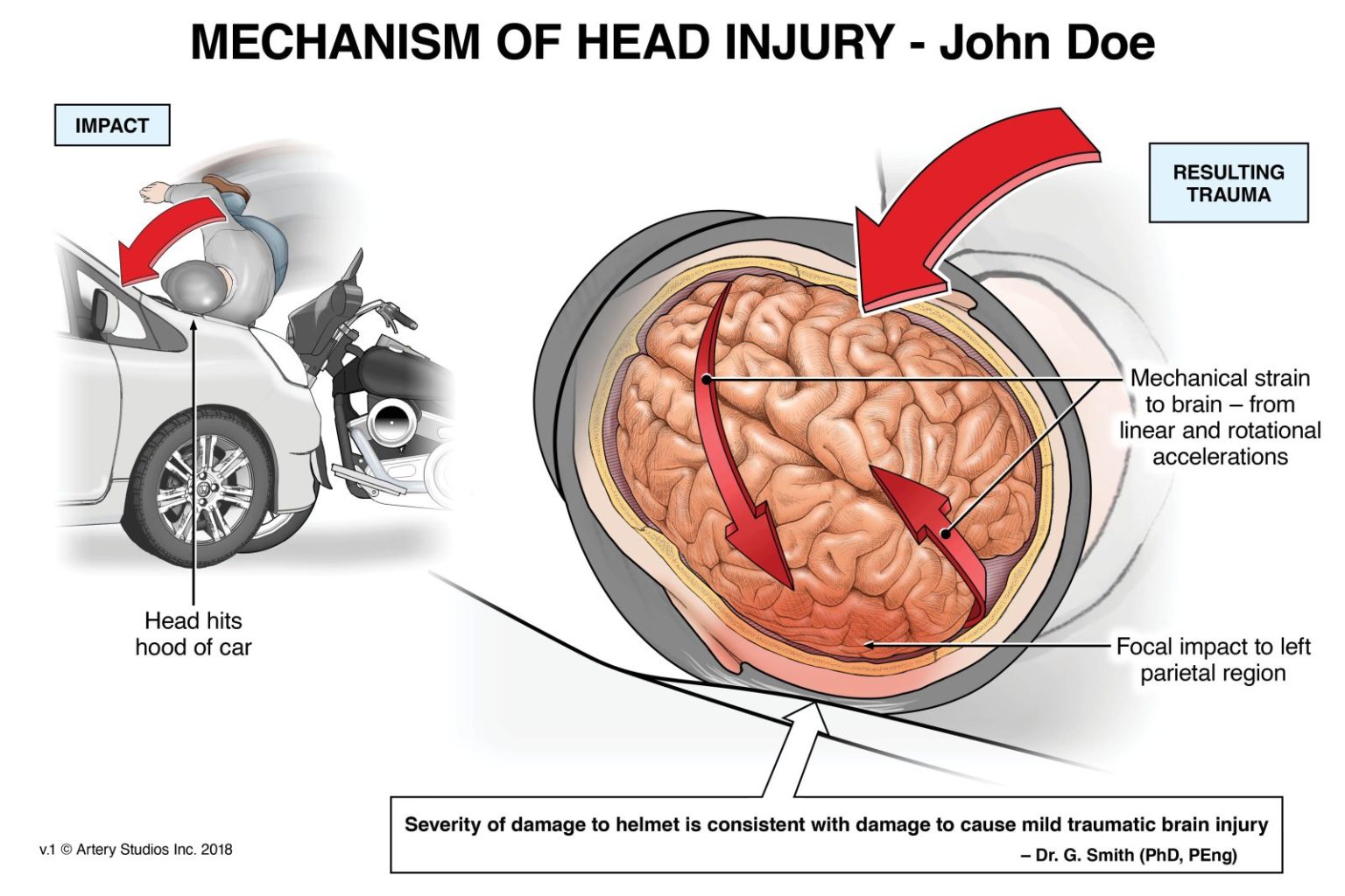 Brain Injury Illustrations & Animations | Artery Studios
