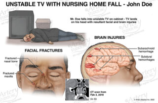 Panel depicting nursing home fall and the injuries that occurred.
