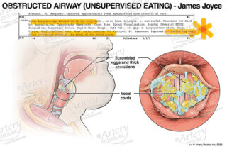 Panel showing obstructed airway due to unsupervised eating, and an excerpt of the medical report from which the information was sourced.