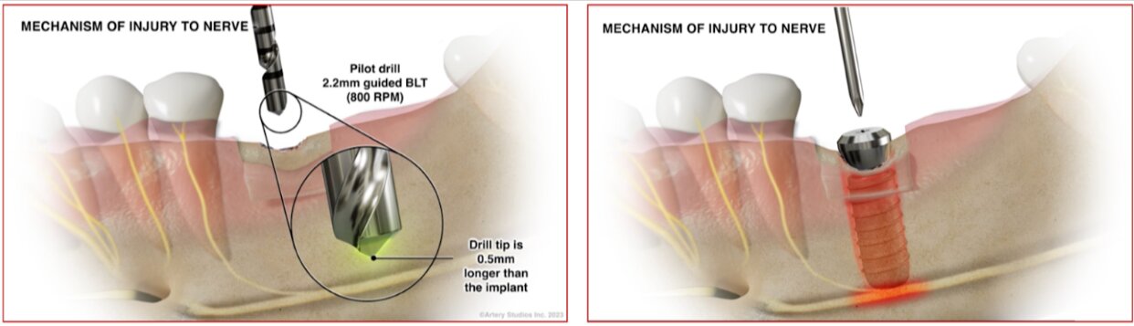 medical animation illustration