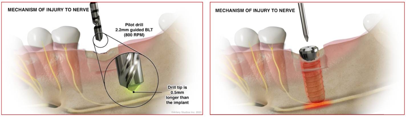 medical animation illustration